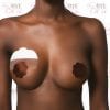 Breast lift and silk nipple cover brown